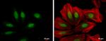 XPC Antibody in Immunocytochemistry (ICC/IF)