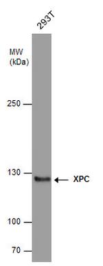 XPC Antibody in Western Blot (WB)