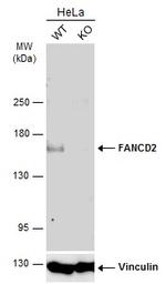 FANCD2 Antibody