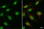 FANCD2 Antibody in Immunocytochemistry (ICC/IF)