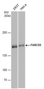 FANCD2 Antibody in Western Blot (WB)