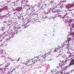 Tyrosine Hydroxylase Antibody in Immunohistochemistry (Paraffin) (IHC (P))