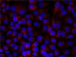 Paxillin Antibody in Immunocytochemistry (ICC/IF)