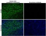 S100B Antibody in Immunohistochemistry (Paraffin) (IHC (P))