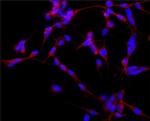 MAP2 Antibody in Immunocytochemistry (ICC/IF)