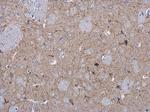 MAP2 Antibody in Immunohistochemistry (Paraffin) (IHC (P))