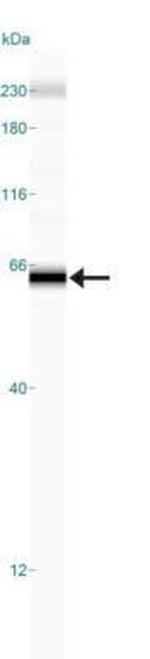 DR4 Antibody in Western Blot (WB)