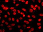 HDAC2 Antibody in Immunocytochemistry (ICC/IF)