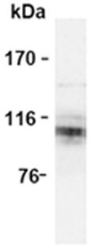 Amyloid Precursor Protein Antibody in Western Blot (WB)