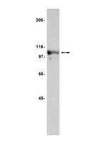 Nucleolin Antibody in Western Blot (WB)