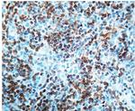 Bcl-2 Antibody in Immunohistochemistry (Paraffin) (IHC (P))