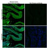 Cytokeratin Pan Antibody in Immunohistochemistry (Paraffin) (IHC (P))