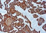 Cytokeratin Pan Type II Antibody in Immunohistochemistry (Paraffin) (IHC (P))