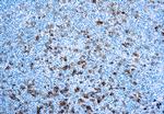 CD30 Antibody in Immunohistochemistry (Paraffin) (IHC (P))