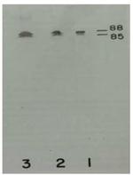 Plasma Kallikrein Antibody in Western Blot (WB)