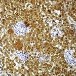 S100 Antibody in Immunohistochemistry (Paraffin) (IHC (P))