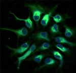 Nestin Antibody in Immunocytochemistry (ICC/IF)