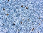 CD15 Antibody in Immunohistochemistry (Paraffin) (IHC (P))