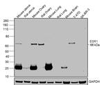 Estrogen Receptor alpha Antibody in Western Blot (WB)