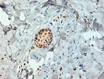 Estrogen Receptor alpha Antibody in Immunohistochemistry (Paraffin) (IHC (P))