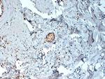 Estrogen Receptor alpha Antibody in Immunohistochemistry (Paraffin) (IHC (P))