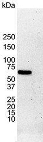 Estrogen Receptor alpha Antibody in Western Blot (WB)