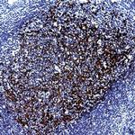 CD21 Antibody in Immunohistochemistry (Paraffin) (IHC (P))