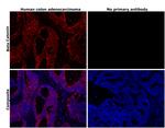 beta Catenin Antibody in Immunohistochemistry (Paraffin) (IHC (P))