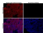 beta Catenin Antibody in Immunohistochemistry (Paraffin) (IHC (P))