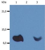 beta-2 Microglobulin Antibody in Western Blot (WB)