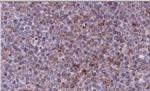 NOXA Antibody in Immunohistochemistry (Paraffin) (IHC (P))