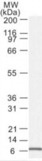 NOXA Antibody in Western Blot (WB)