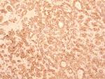 TEM8 Antibody in Immunohistochemistry (Paraffin) (IHC (P))