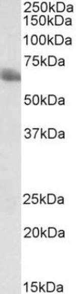 TEM8 Antibody in Western Blot (WB)