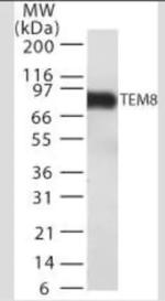 TEM8 Antibody in Western Blot (WB)