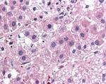 IL-25 Antibody in Immunohistochemistry (Paraffin) (IHC (P))