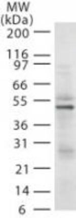 RAD18 Antibody in Western Blot (WB)