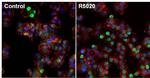 Progesterone Receptor Antibody