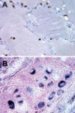 Bi-1 Antibody in Immunohistochemistry (Paraffin) (IHC (P))