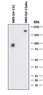 SARS Coronavirus Spike Protein Antibody in Western Blot (WB)