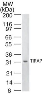 TIRAP Antibody in Western Blot (WB)