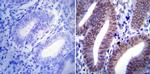 Progesterone Receptor Antibody in Immunohistochemistry (IHC)