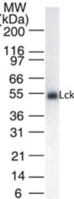 LCK Antibody in Western Blot (WB)