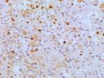 APIP Antibody in Immunohistochemistry (Paraffin) (IHC (P))