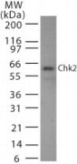 CHK2 Antibody in Western Blot (WB)