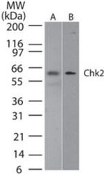 CHK2 Antibody in Western Blot (WB)