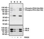 Phospho-Progesterone Receptor (Ser294) Antibody in Western Blot (WB)