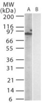 TLR12 Antibody in Western Blot (WB)