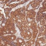 CIP2A Antibody in Immunohistochemistry (Paraffin) (IHC (P))