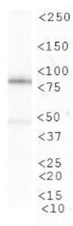 CIP2A Antibody in Western Blot (WB)